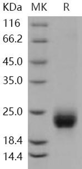 Human R-Spondin 1/RSPO1 Recombinant Protein (RPES1997)