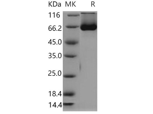Mouse SHP2/PTPN11 Recombinant Protein (RPES2038)