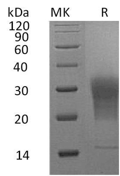 Mouse LAIR1 Recombinant Protein (RPES2065)