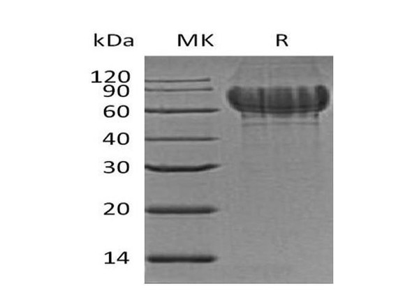 Mouse Bone Sialoprotein 2 Recombinant Protein (RPES2092)