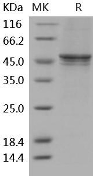 Human GSK3B Recombinant Protein (RPES2093)