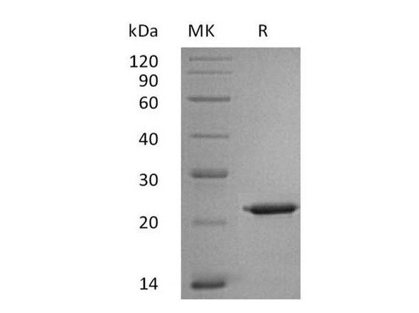 Human Interleukin8/IL8 Recombinant Protein (RPES2102)