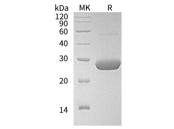 Human LYPLA2 Recombinant Protein (RPES2111)