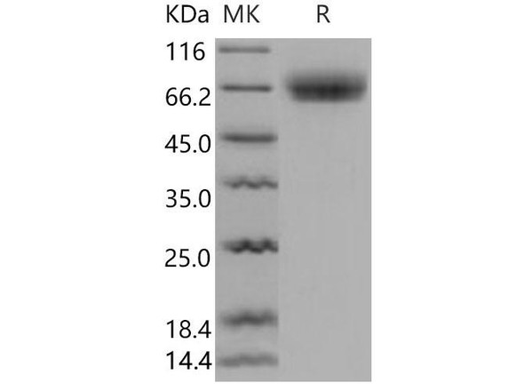Mouse Osteomodulin/OMD Recombinant Protein (RPES2120)