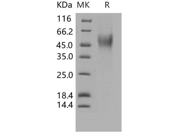 Human CD16b/FCGR3B Recombinant Protein (RPES2121)