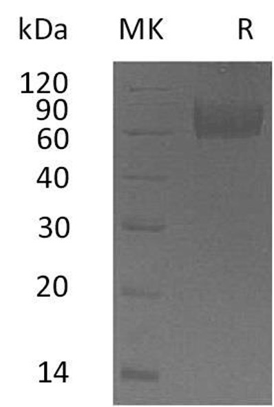 Human IL18BP Recombinant Protein (RPES2124)