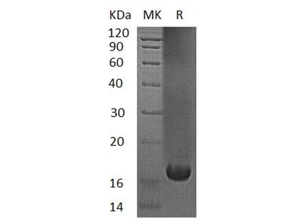 Human UBE2V1 Recombinant Protein (RPES2147)