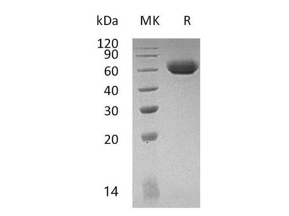 Mouse LAG3 Recombinant Protein (RPES2171)