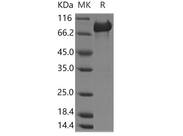 Human PCK2 Recombinant Protein (RPES2178)