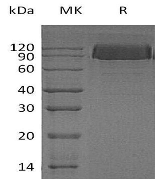 Human PDGFRB/CD140b Recombinant Protein (RPES2189)