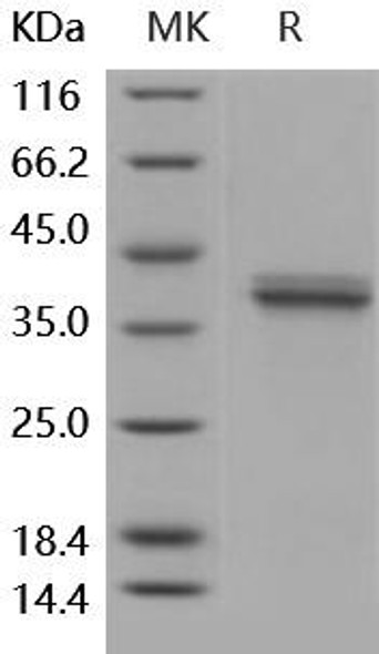 Human Cathepsin L2/CTSL2 Recombinant Protein (RPES2203)