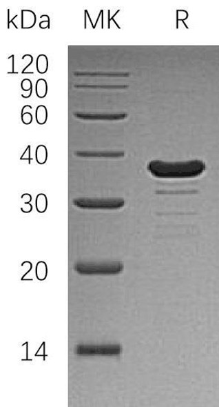 Human GALE Recombinant Protein (RPES2211)