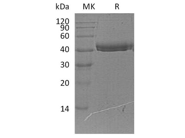 Human COL9A1 Recombinant Protein (RPES2217)