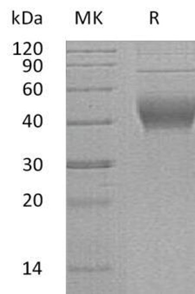 Human IL-22BP/IL22RA2 Recombinant Protein (RPES2226)