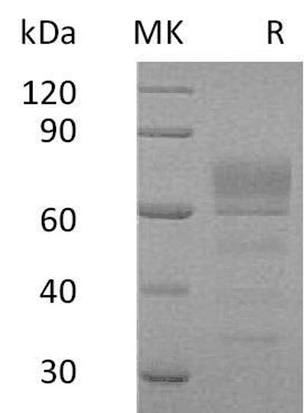 Human Podoplanin/PDPN Recombinant Protein (RPES2251)