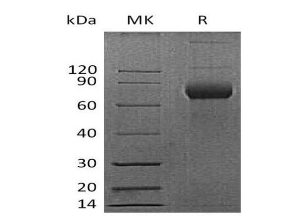 Mouse CD38 Recombinant Protein (RPES2280)