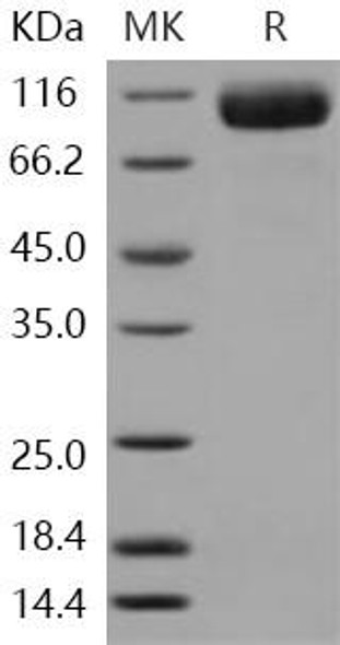 Human CD97 Recombinant Protein (RPES2282)