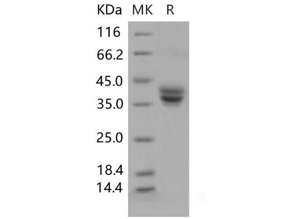 Mouse GPA33/Glycoprotein A33 Recombinant Protein (RPES2292)