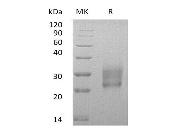 Human HAI-2/SPINT2 Recombinant Protein (RPES2298)