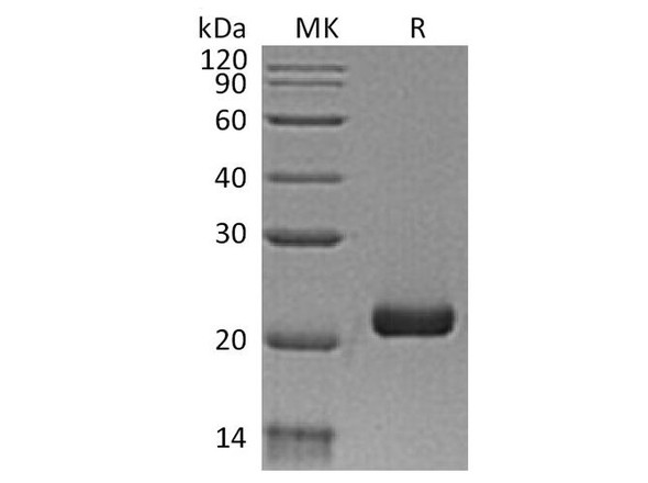 Human IFN-L3/IL-28B Recombinant Protein (RPES2310)
