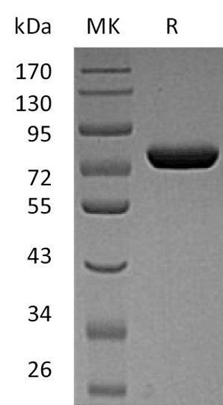 Human POMGNT1 Recombinant Protein (RPES2377)