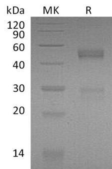 Mouse NOV/CCN3 Recombinant Protein (RPES2380)