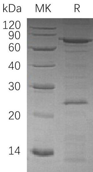 Human VCP Recombinant Protein (RPES2399)