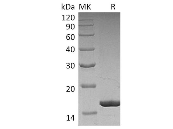 Human G-CSF/CSF3 Recombinant Protein (RPES2407)
