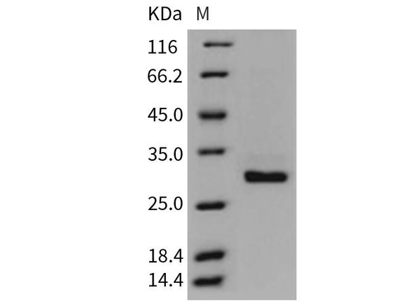 Mouse CRP/C-Reactive Recombinant Protein (RPES2415)