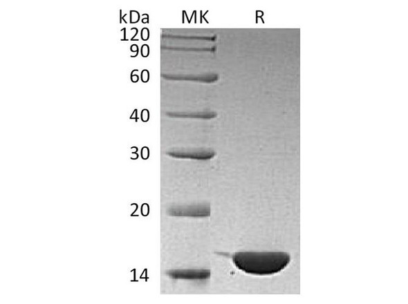 Human IL36G/IL1F9 Recombinant Protein  (RPES2420)