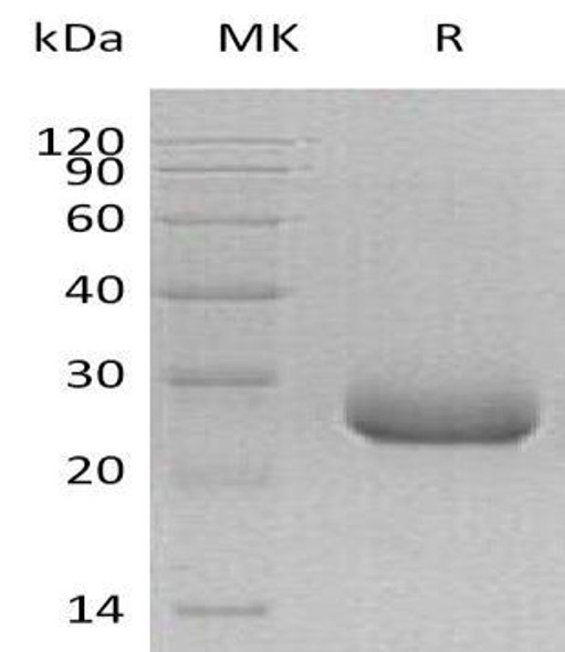 Human PRADC1/PAP21 Recombinant Protein (RPES2421)