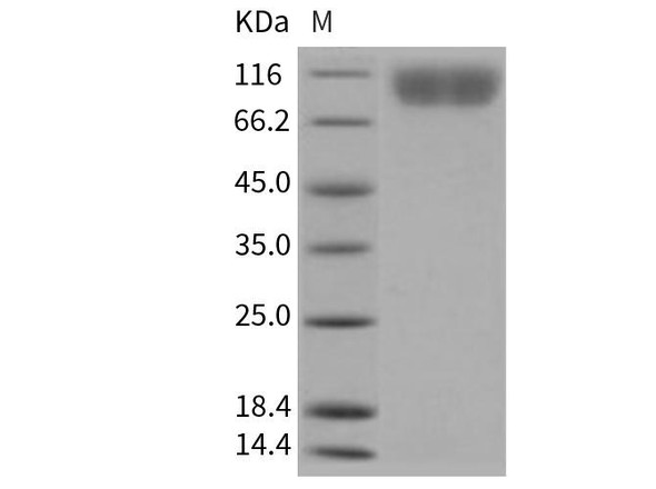 Human PDGFRB/CD140b Recombinant Protein (RPES2434)