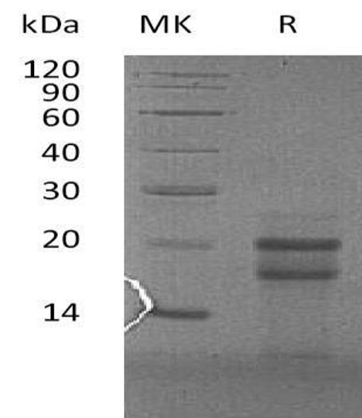 Human PFDN4 Recombinant Protein (RPES2484)