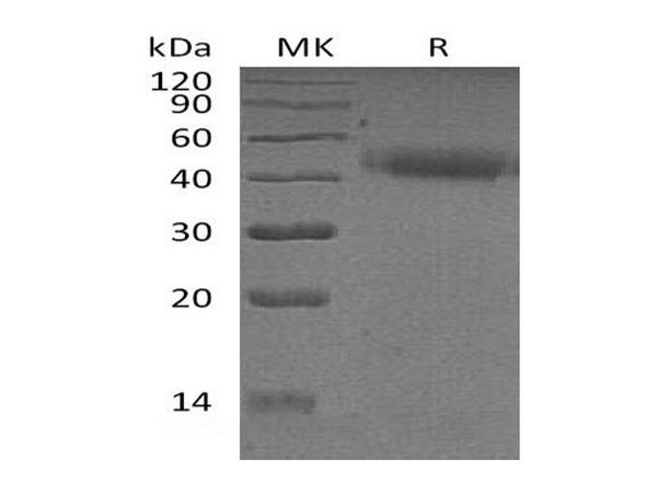 Human PSG2 Recombinant Protein (RPES2523)