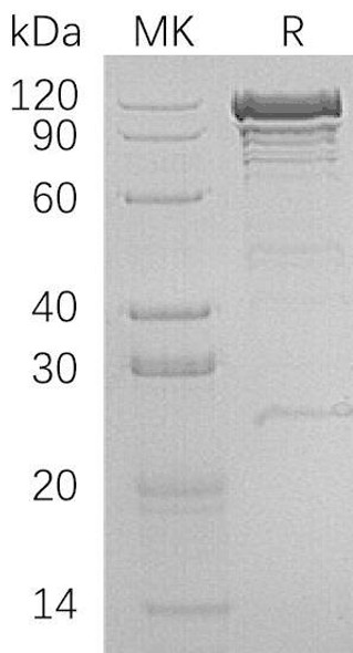 Human VCL/Vinculin Recombinant Protein (RPES2524)