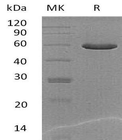 Mouse CPQ/PGCP Recombinant Protein (RPES2565)