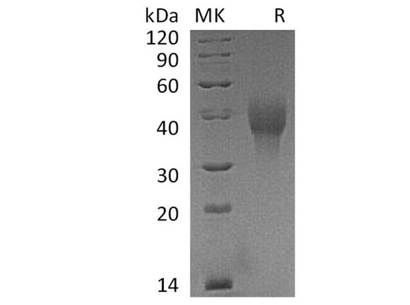 Cynomolgus OX40/TNFRSF4 Recombinant Protein (RPES2571)