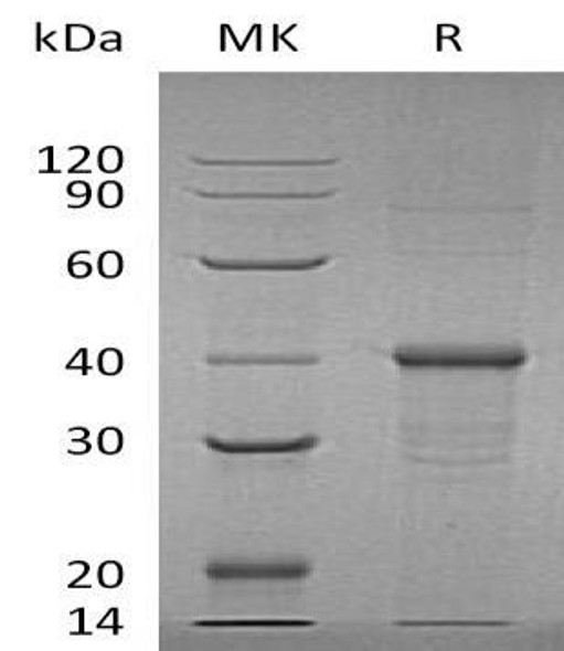 Human BDH1 Recombinant Protein (RPES2581)