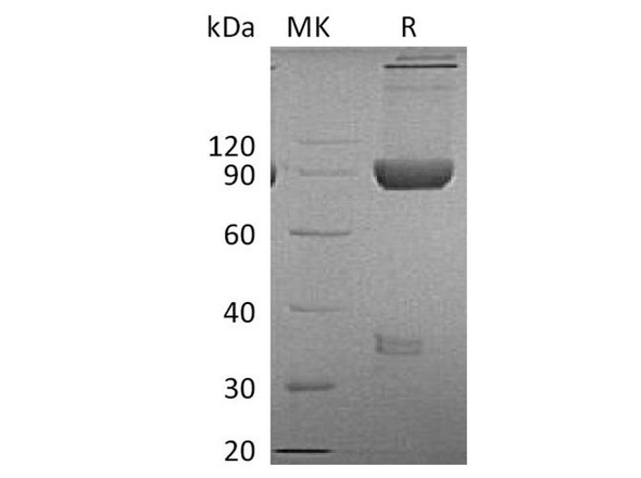 Cynomolgus LAG-3/CD223 Recombinant Protein (RPES2592)