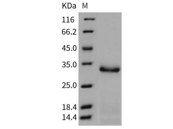 Mouse Trypsin 2/PRSS2 Recombinant Protein (RPES2599)