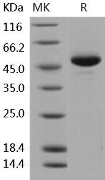 Human BLyS/TNFSF13B/BAFF Recombinant Protein (RPES2617)