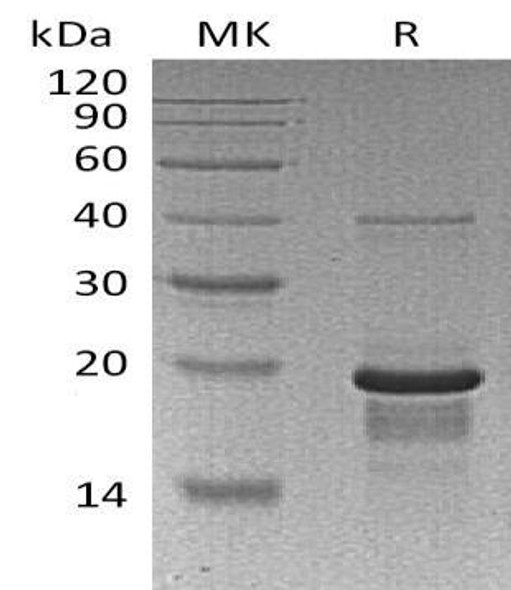 Human EGR1 Recombinant Protein (RPES2623)