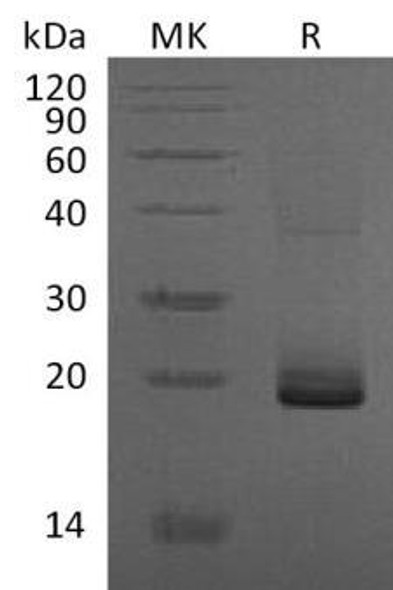 Mouse ESM1/Endocan Recombinant Protein (RPES2660)
