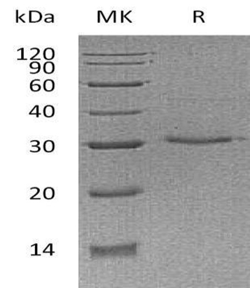 Human VSIG8 Recombinant Protein (RPES2668)