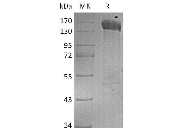 Human Jagged 1/JAG1 Recombinant Protein (RPES2673)