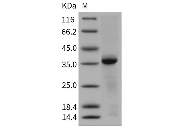Human Cathepsin L/CTSL Recombinant Protein (RPES2679)