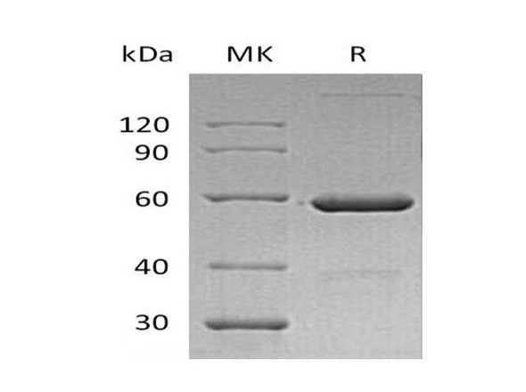 Human VSIG8 Recombinant Protein (RPES2689)