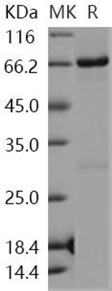 Human NLK Recombinant Protein (RPES2704)