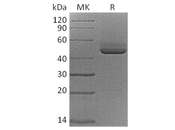 Cynomolgus TIGIT/VSIG9/VSTM3 Recombinant Protein (RPES2717)