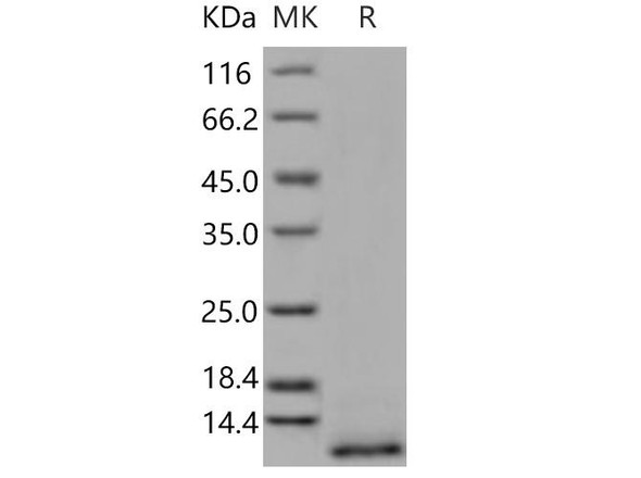 Human CD9/Tspan-29 Recombinant Protein (RPES2718)
